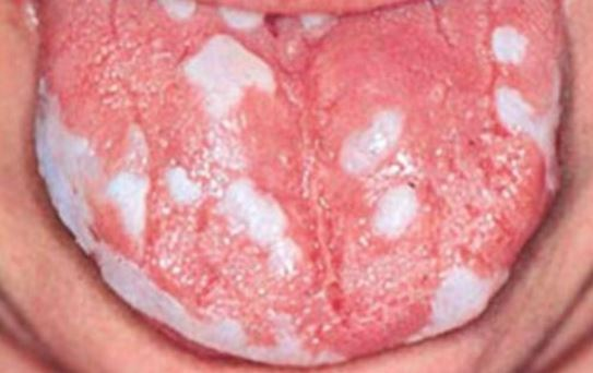 how to treat troubling mouth problems